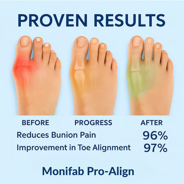 Monifab® Pro-Align